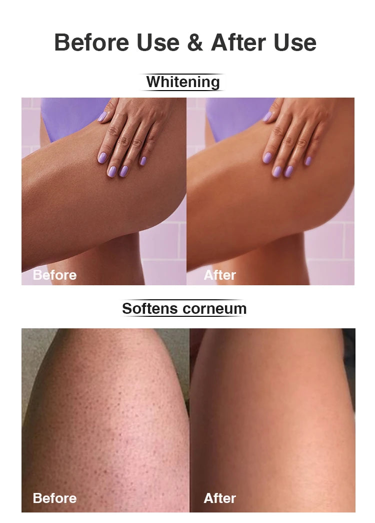 AILKE Ensemble de soins éclaircissants pour la peau