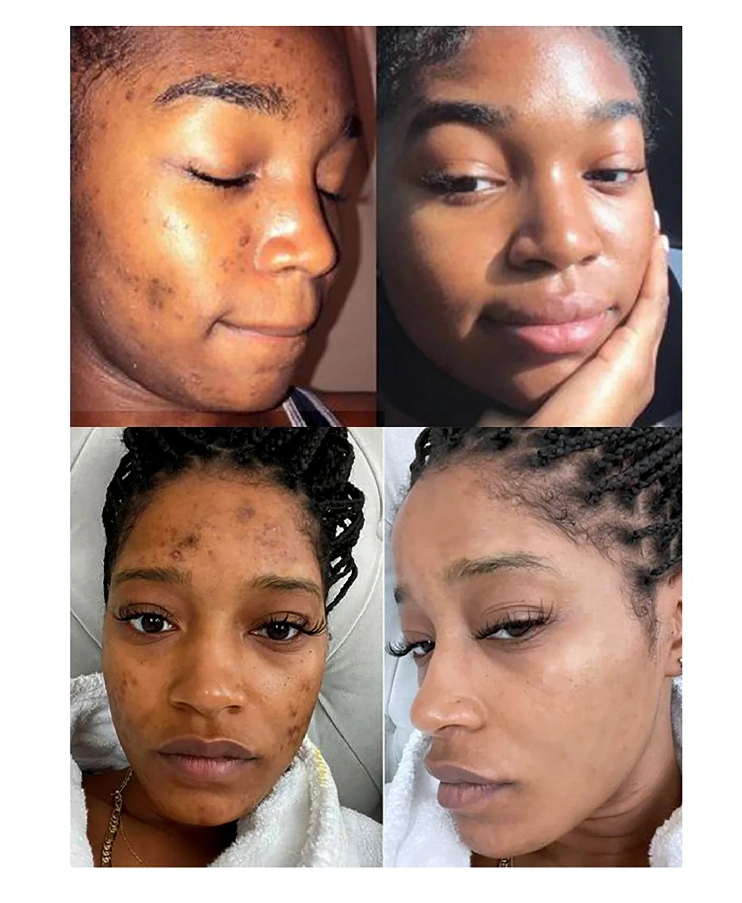 AILKE Ensemble de soins éclaircissants pour la peau